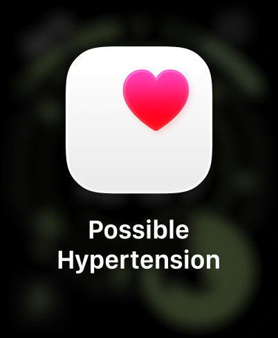 Apple Watch Ultra 3, κάσα από τιτάνιο, φυσικό χρώμα, γνωστοποίηση πιθανής υπέρτασης, ροζ καρδιά σε άσπρο κουτί, λουράκι, Trail Loop, μπλε/γαλάζιο χρώμα